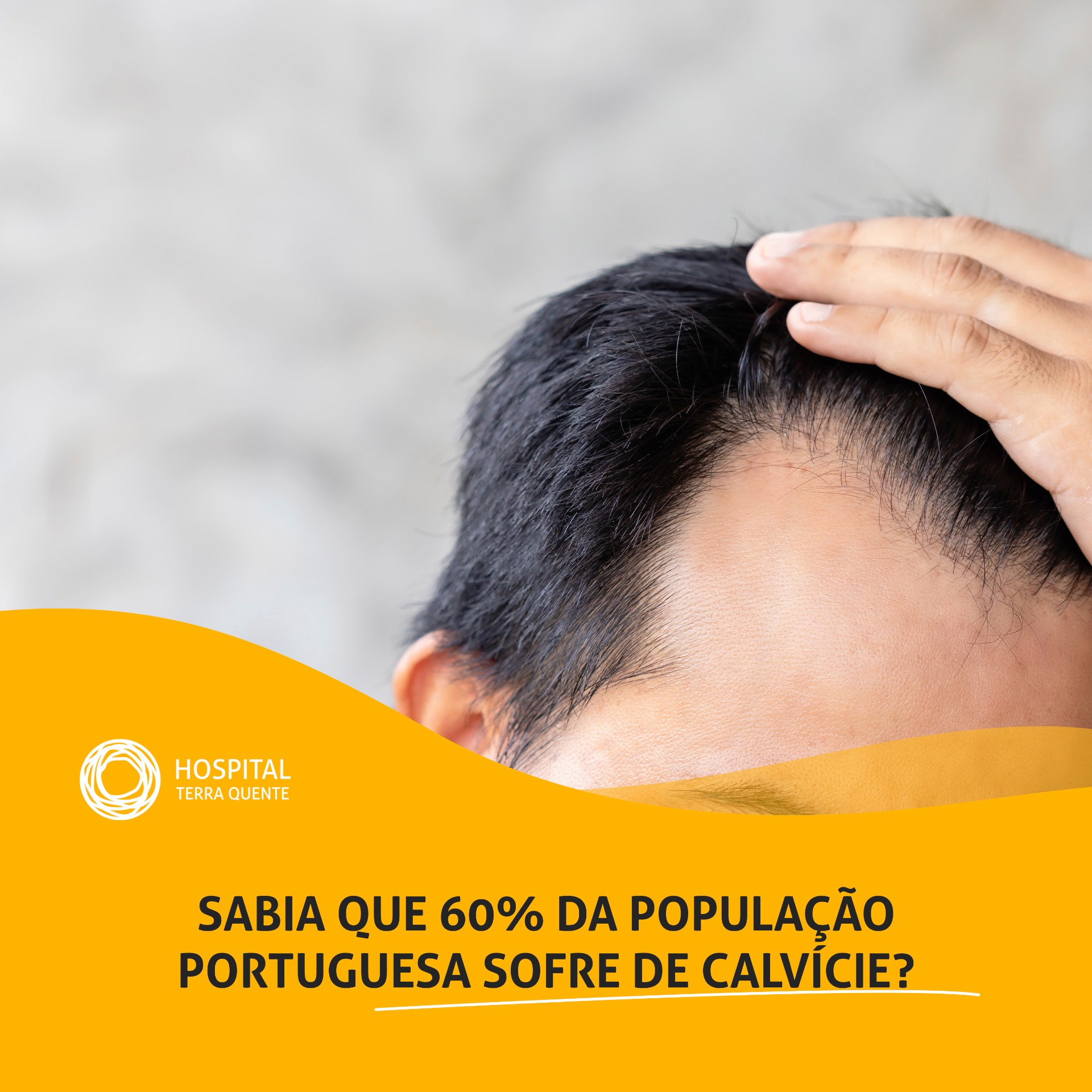 A calvície é um dos problemas mais temidos por qualquer pessoa